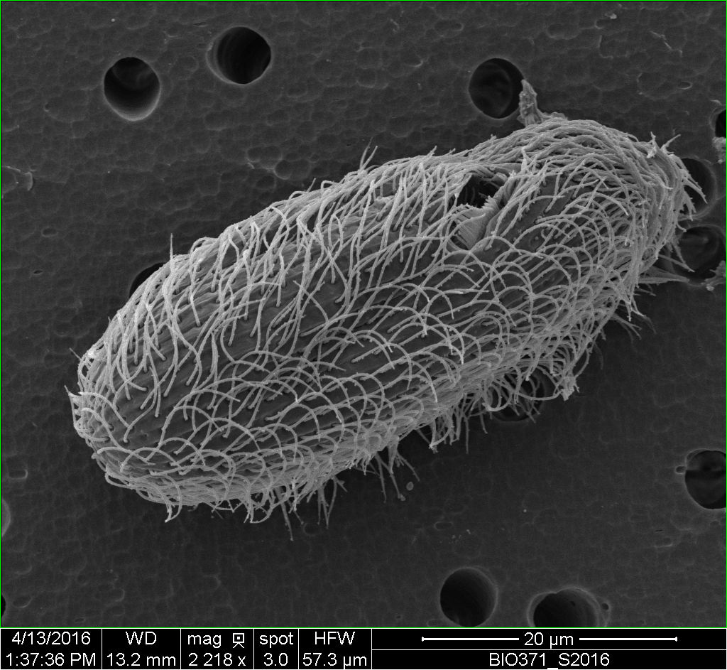 Scanning Electron Microscopy Gallery Center for Microscopy and Imaging